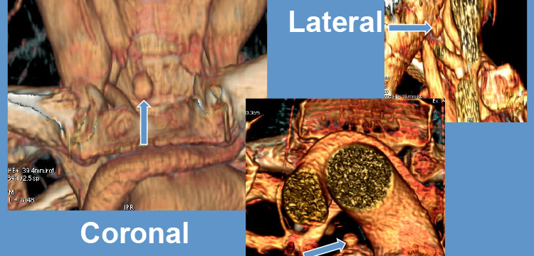 4D CT Imaging