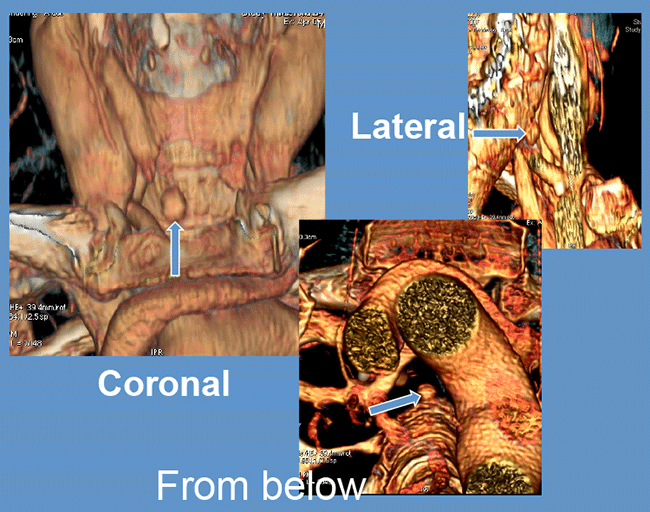 4d-ct