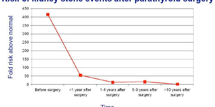 Kidney Stones