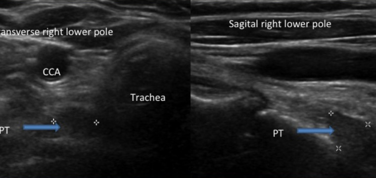 Preop Imaging